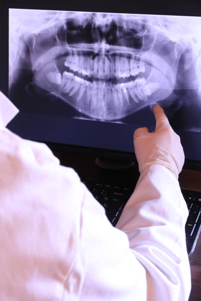 Best Emergency Dental Services for Seniors in Athens, AL