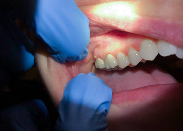 Best Emergency Dentist for Special Needs Patients in Athens, AL